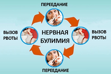 Лечение булимии в Липках